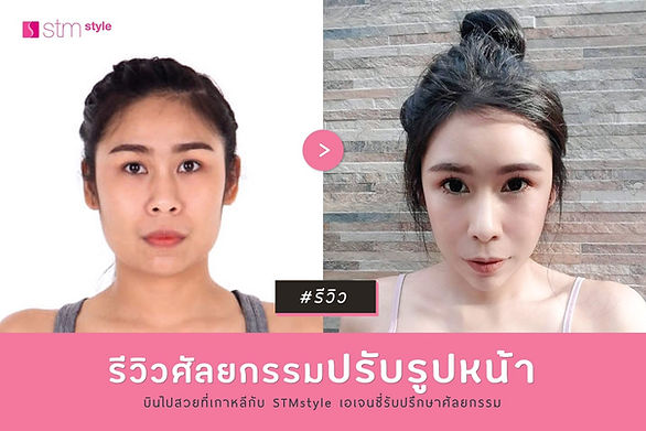 ทุบทั้งหน้า