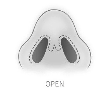 open-nose