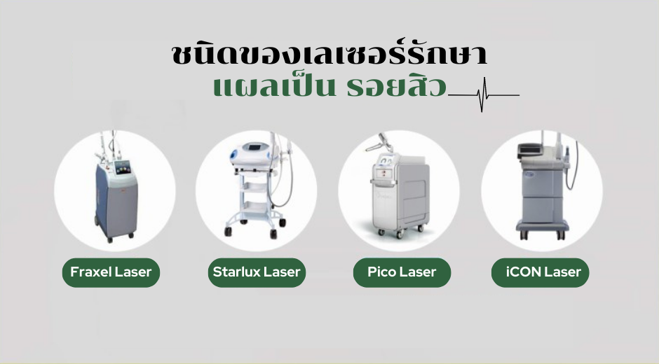  acne scar removal laser