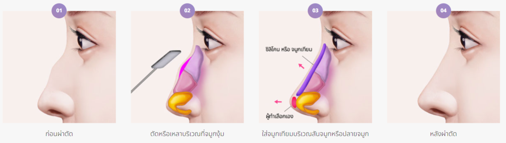 จมูกผู้ชาย