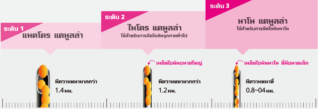 ฉีดไขมันหน้า